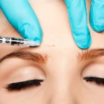 فیلر خط اخم