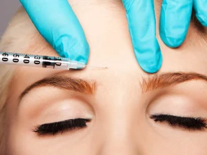 فیلر خط اخم