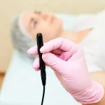 لیزر موهای سفید