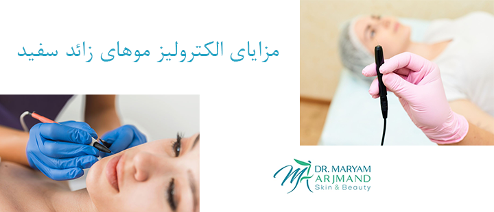 مزایای الکترولیز مو‌های زائد سفید
