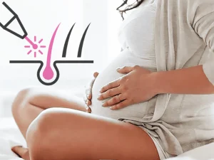 لیزر موهای زائد در بارداری